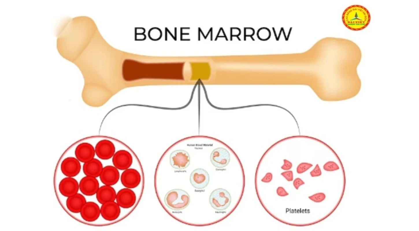 Những Điều Cần Biết Về Đa U Tuỷ Xương | Trường Cao Đẳng Đại Việt Sài Gòn