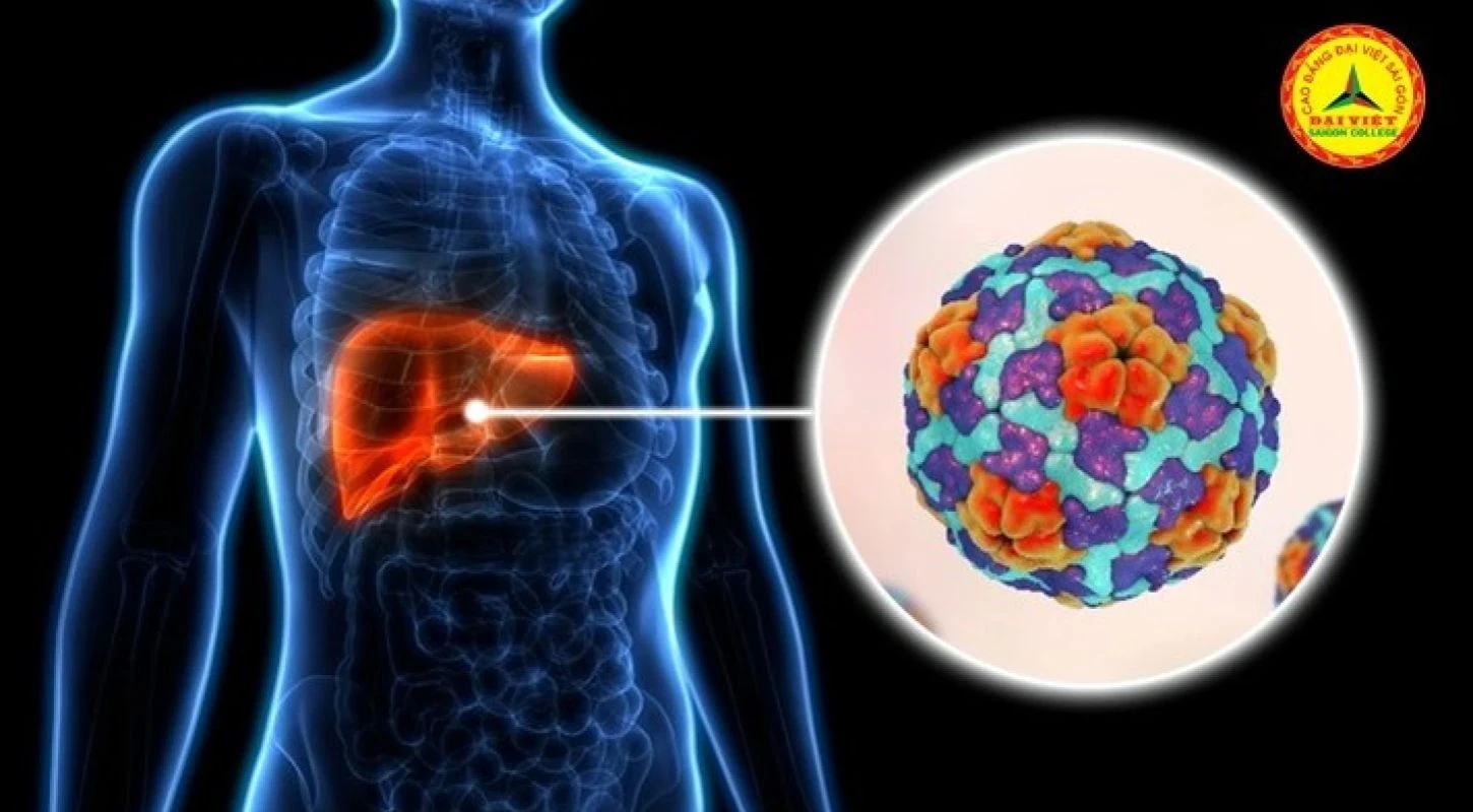 Viêm Gan Vi Rút A, Những Điều Cần Biết | Trường Cao Đẳng Đại Việt Sài Gòn