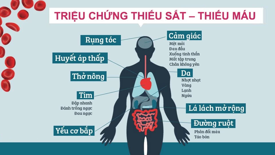 Triệu chứng thiếu sắt, thiếu máu
