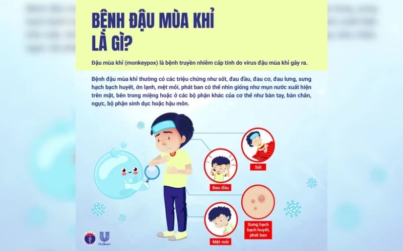 Chủ Động Phòng Chống Bệnh Đậu Mùa Khỉ