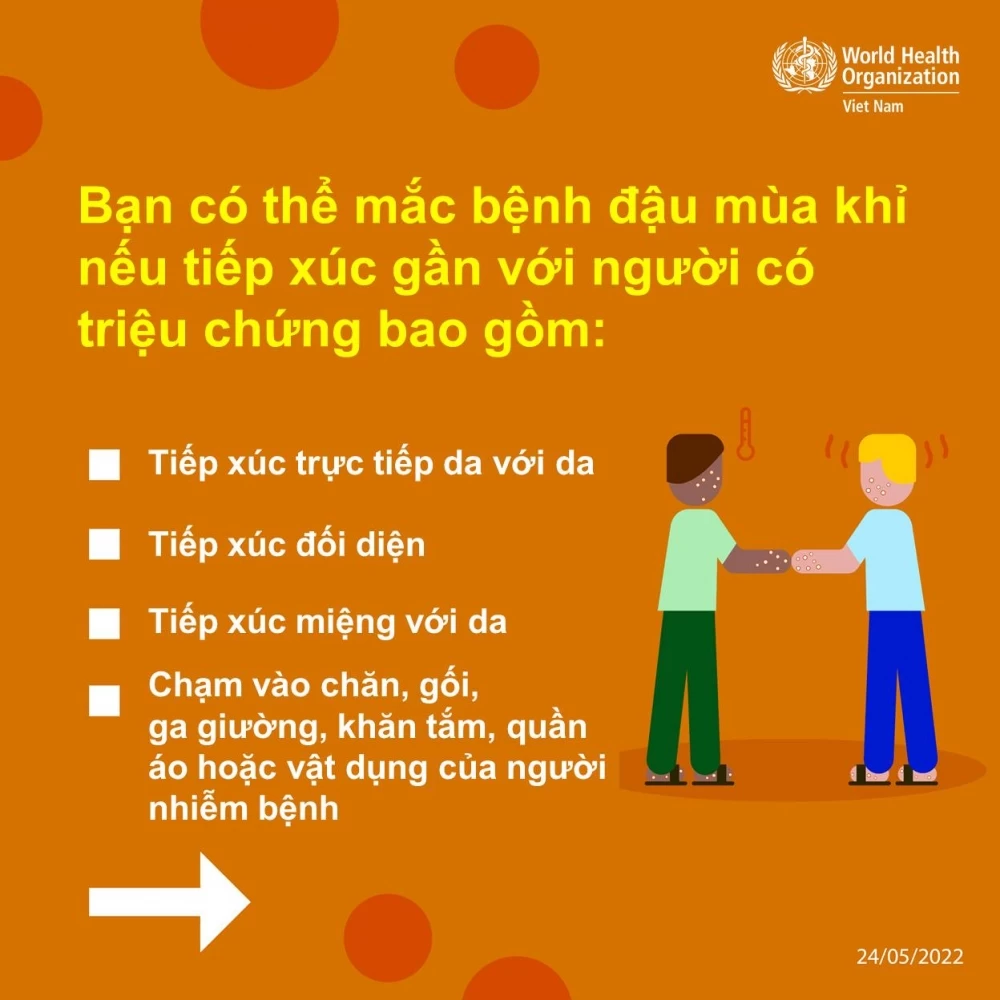 Những Điều Cần Biết Bệnh Đậu Mùa Khỉ - 4