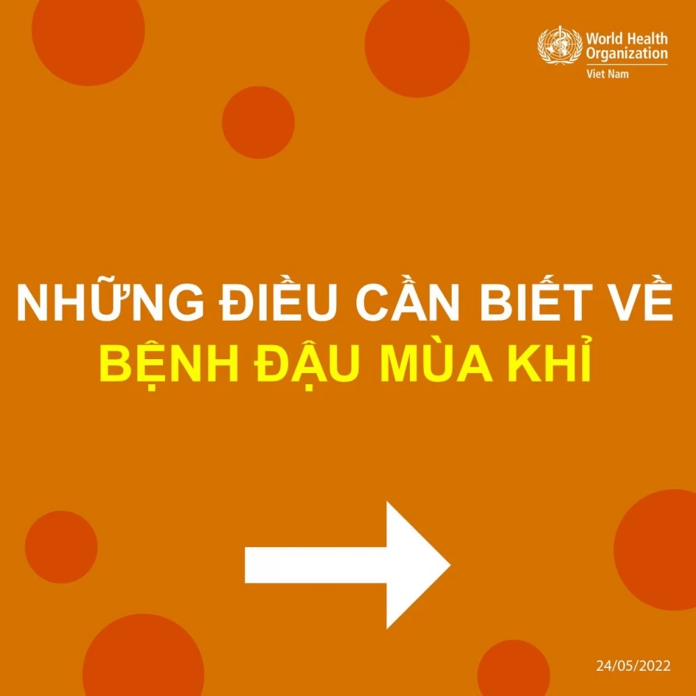 Những Điều Cần Biết Bệnh Đậu Mùa Khỉ - 1