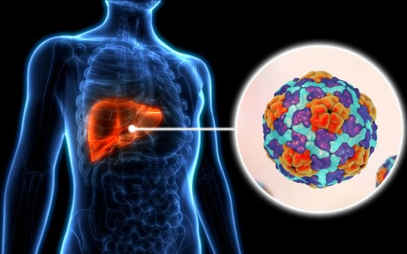 Viêm Gan Vi Rút A, Những Điều Cần Biết